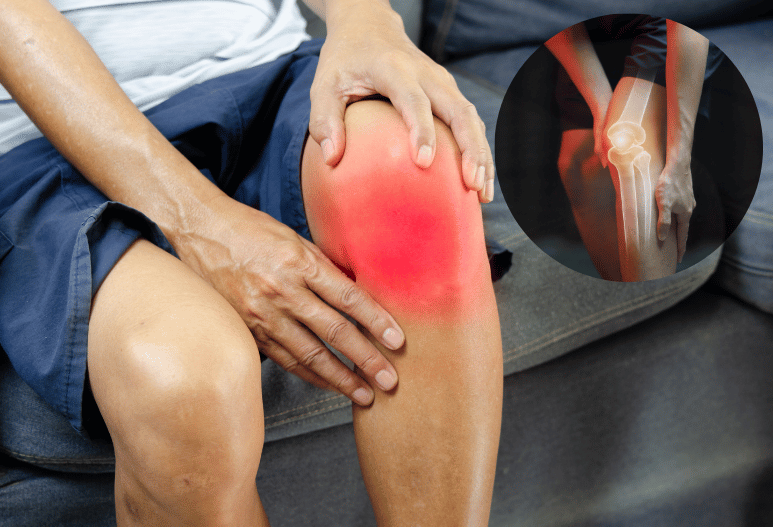 Orthopaedics & Joint Replacement