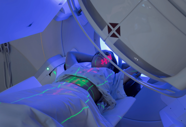 Radiotherapy Services