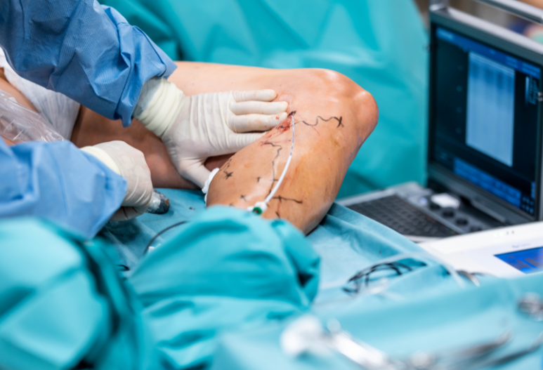 Vascular Surgery Services